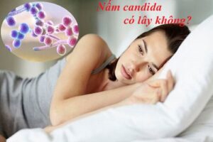 Viêm âm đạo do Candida có lây không? cách phòng bệnh hiệu quả
