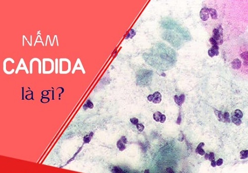 Viêm âm đạo do Candida có lây không? cách phòng bệnh hiệu quả