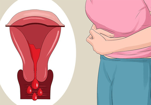 Viêm lộ tuyến cổ tử cung tái phát như thế nào, nguyên nhân do đâu?