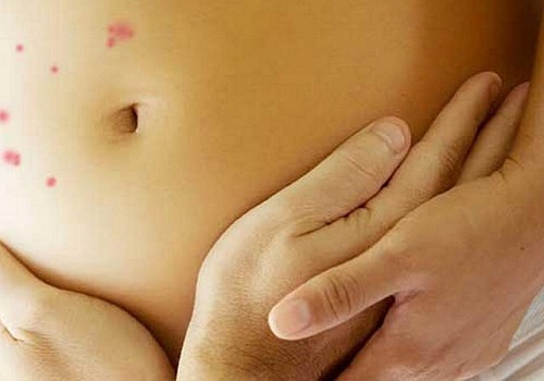 Mọc mụn cóc, herpes sinh dục ở vùng kín khi mang thai, cảnh bảo từ chuyên gia