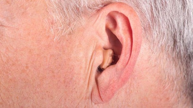 Dái tai có nếp nhăn là dấu hiệu y.ế.u s.i.n.h l.ý dễ nhận biết