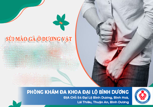 sùi mào gà dương vật
