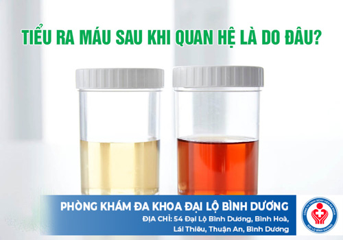 tiểu ra máu sau quan hệ