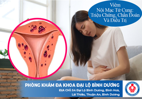 Viêm Nội Mạc Tử Cung
