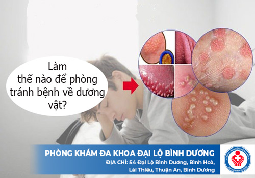 các bệnh về dương vật thường gặp