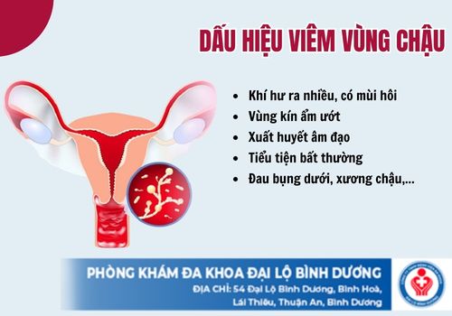 điều trị viêm vùng chậu ở Bình Dương