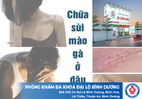 địa chỉ chữa sùi mào gà ở Bình Dương