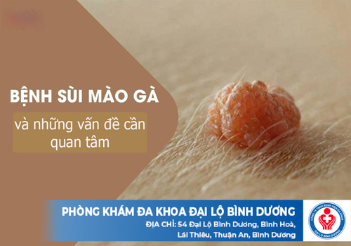 bệnh sùi mào gà và những vấn đề cần quan tâm