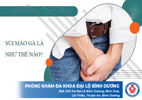 bệnh sùi mào gà và những vấn đề cần quan tâm