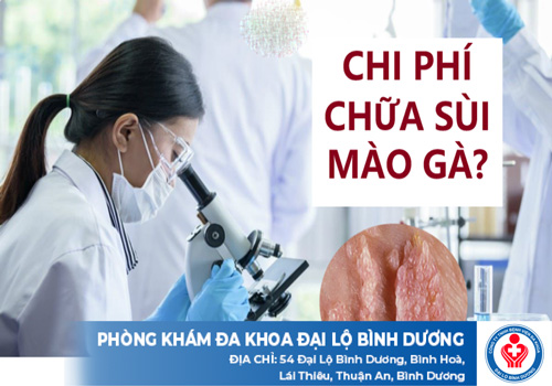 chi phí điều trị sùi mào gà tại Bình Dương