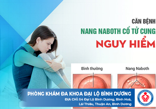 Chi phí đốt nang naboth cổ tử cung ở Bình Dương