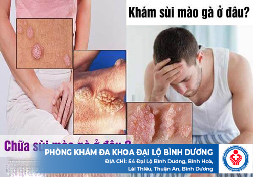 địa chỉ chữa sùi mào gà ở Bắc Tân Uyên