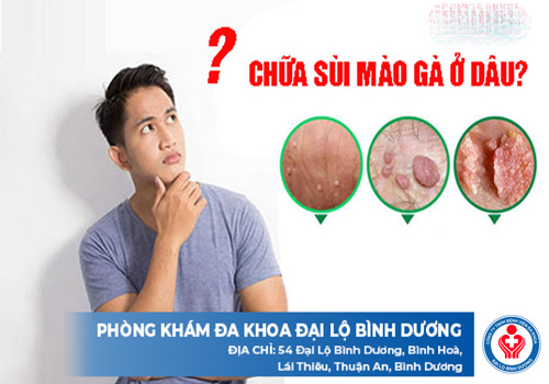 địa chỉ chữa sùi mào gà ở Dầu Tiếng