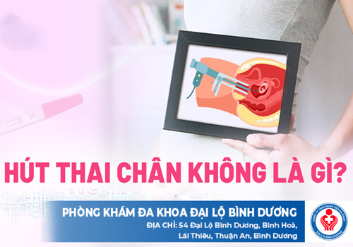 phá thai bằng phương pháp hút chân không