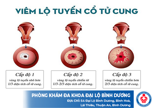 khi hu von cuc 2