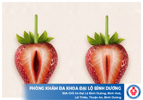thu hep vung kin dau tieng 1