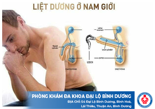 tim hieu benh liet duong 1