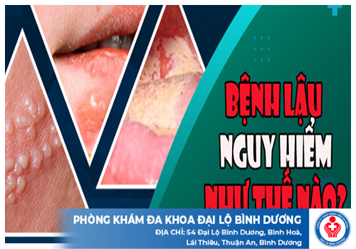 top chua benh lau dau tieng 2