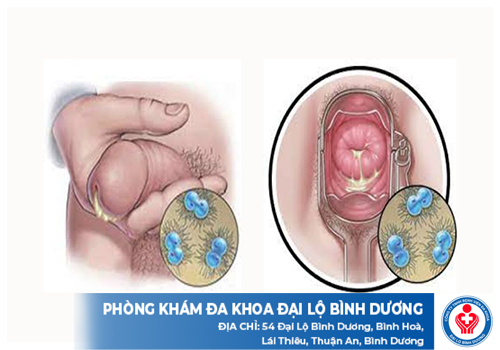 top dia chi chua benh lau di an 3