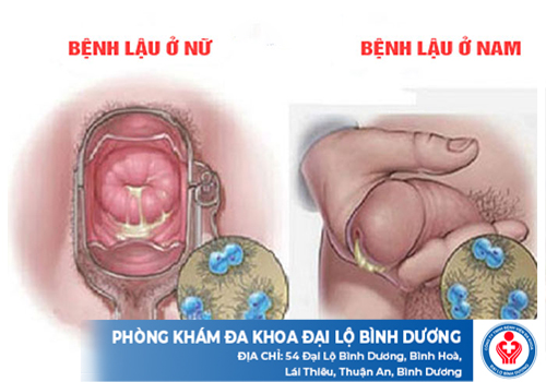 top dia chi chua benh lau ltta 2