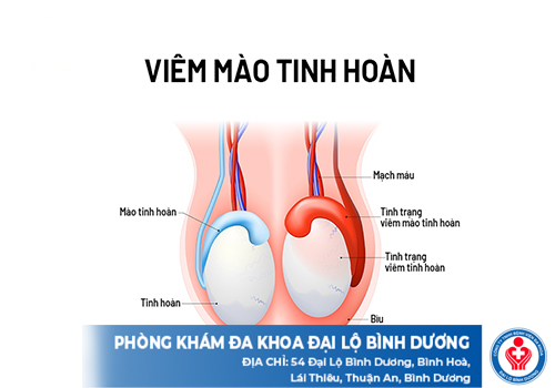 viem mao tinh hoan