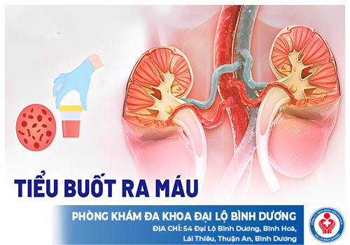 dieu tri tieu buot ra mau o nam gioi 1