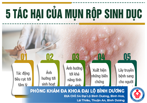 kham benh mun rop sinh duc o dau tphcm 19701 1