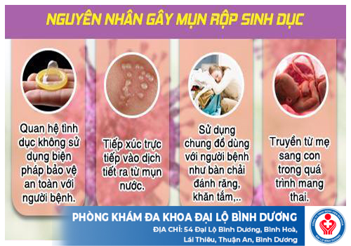 kham benh mun rop sinh duc o tay ninh 19818 1