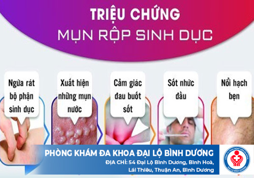 kham benh mun rop sinh duc o di an 1