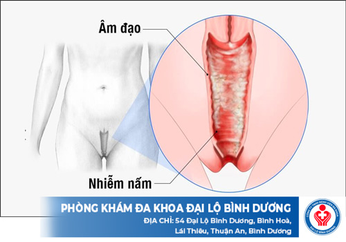 top phong kham benh nam phu khoa o dau tieng 1