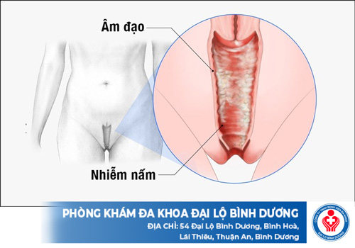 top phong kham benh nam phu khoa o dong nai 1