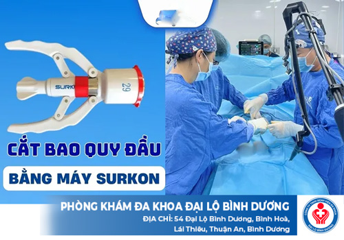 hi phi cat bao quy dau bang may surkon 1