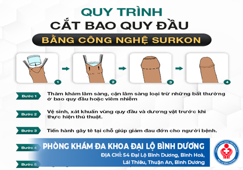 quy trinh cat bao quy dau bang ky thuat moi20572 1