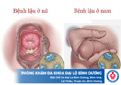 kham benh lau go vap 1