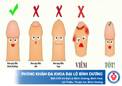 khi nao nen cat bao quy dau 1