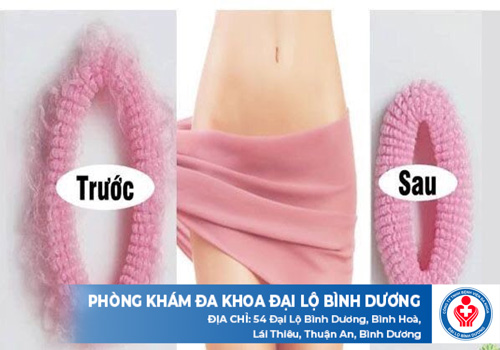 top phong kham cat moi am dao o dau tieng 1