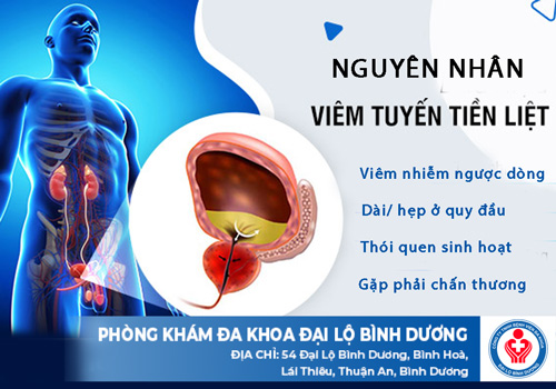 nam nguyen nhan de dieu tri viem tuyen tien liet toi uu nam nguyen nhan de dieu tri viem tuyen tien liet toi uu