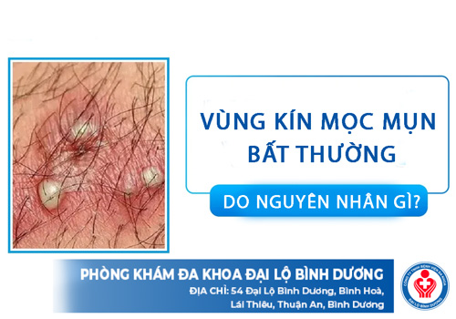 vung kin moc mun bat thuong do nguyen nhan gi vung kin moc mun bat thuong do nguyen nhan gi